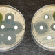Illustration for article titled Antibiotic Resistance Could Spark Devastating Outbreaks